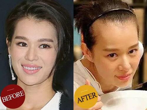 脱发的女明星,揭秘明星脱发背后的真相与应对之道”